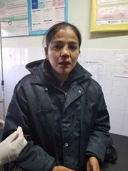 policíaslesionadas2