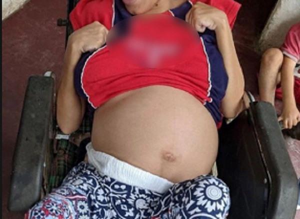 cuadriplejicaembarazada