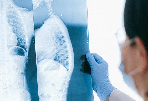 impacto_cancer_pulmon1