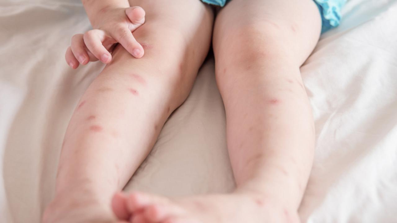 leishmaniosis-mosca-arena