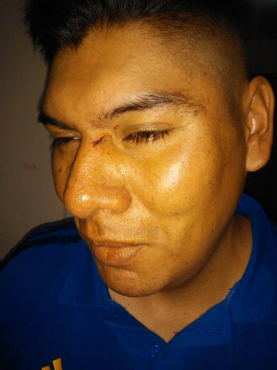 Inspectores agredidos 