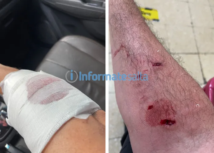 nuevo ataque Pitbull 2