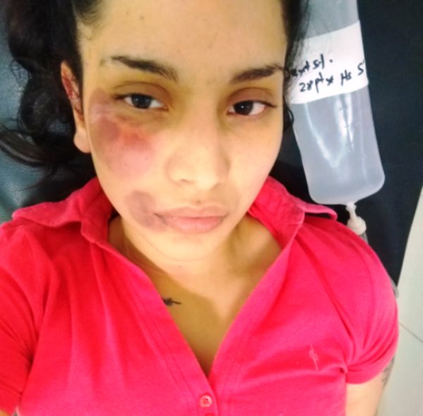 escrache denuncia joven atacada