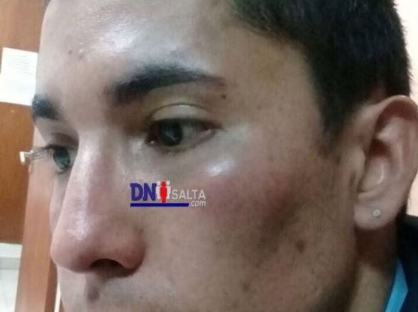 chofer agredido - copia