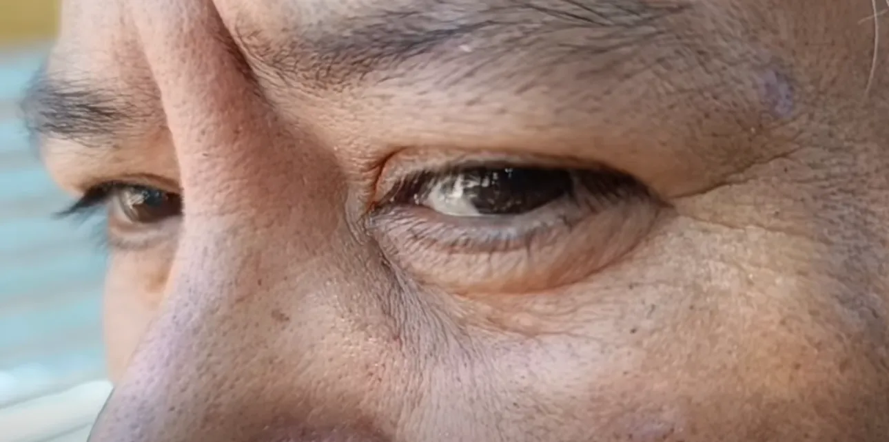 Operación ojo - Embarcación