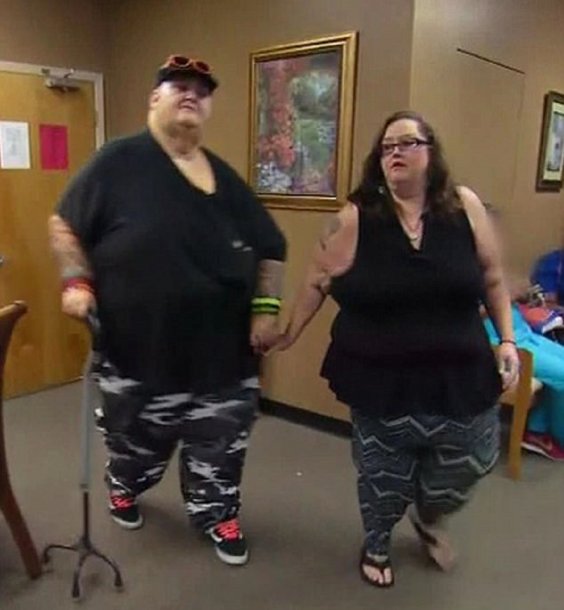 obesidad  - pareja 3