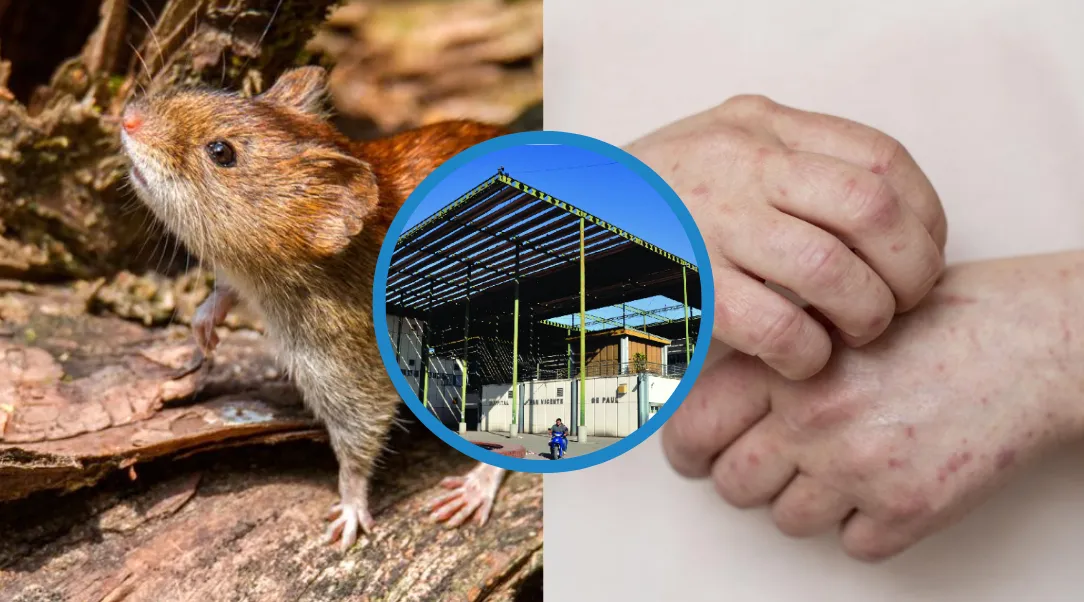 Sarampión y Hantavirus - Hospital de Orán