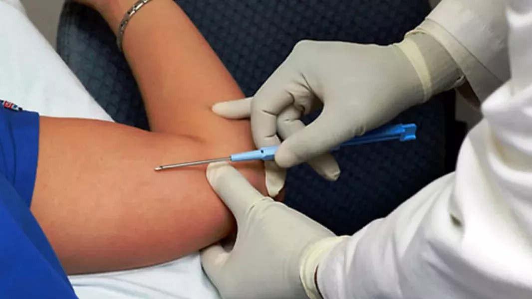 Implantes subdérmicos