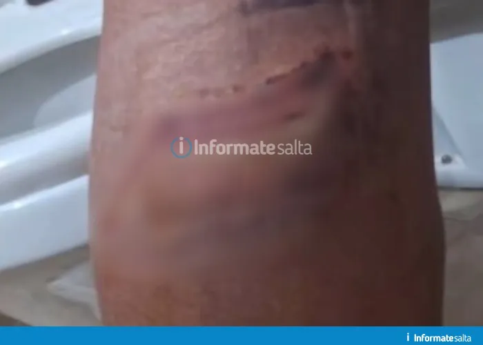 herida mordida de perro