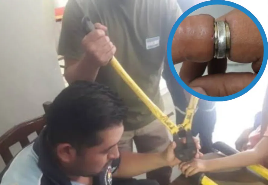 Anillos - Bomberos Orán