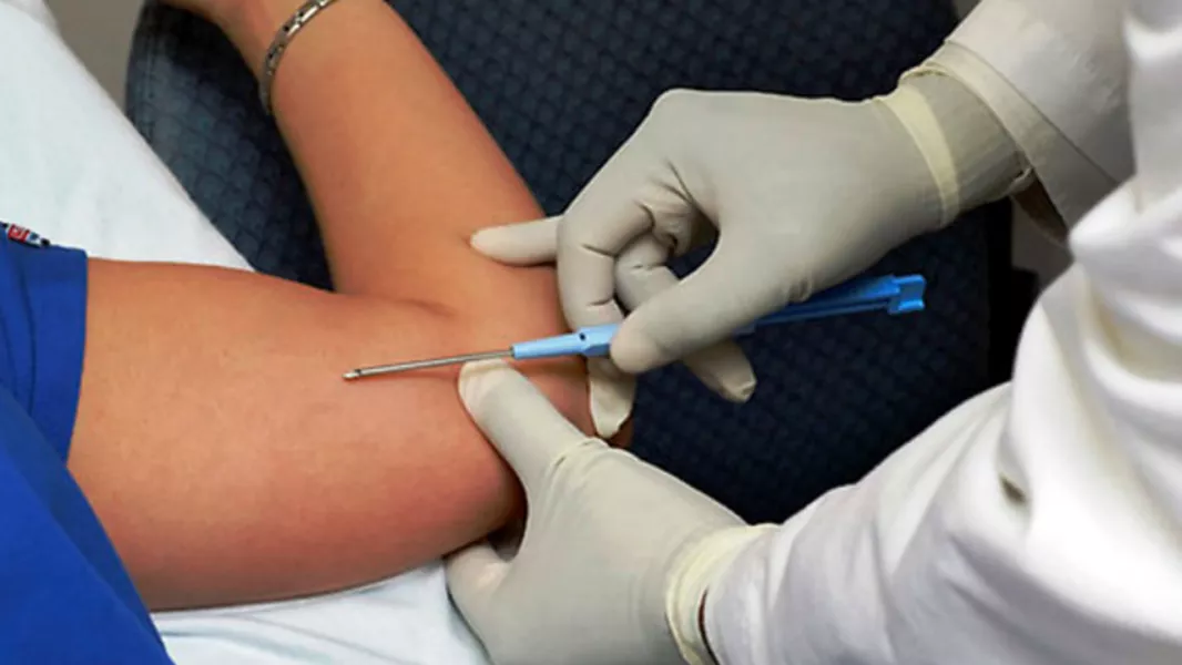 Implantes subdérmicos