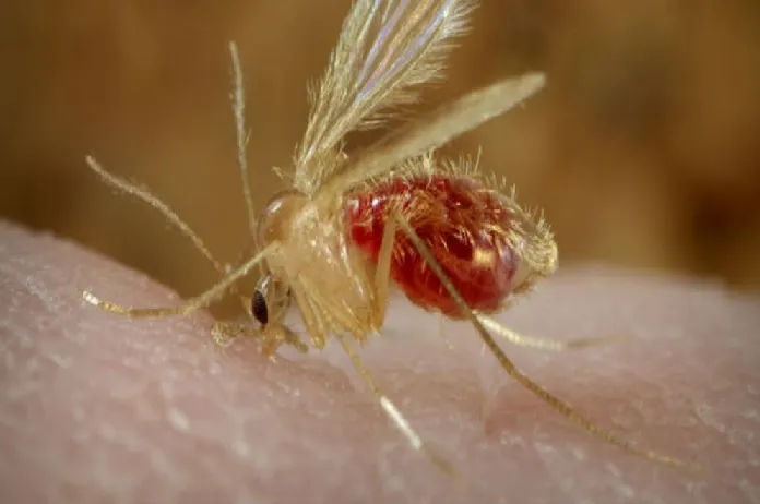 leishmaniasis visceral