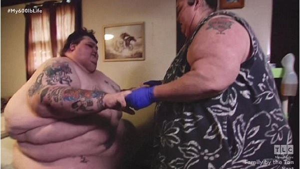 obesidad  - pareja 1