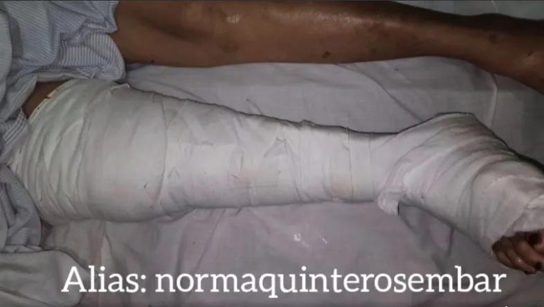 caballo embarcacion operacion