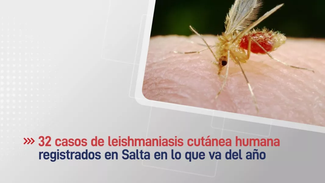 Leishmaniasis